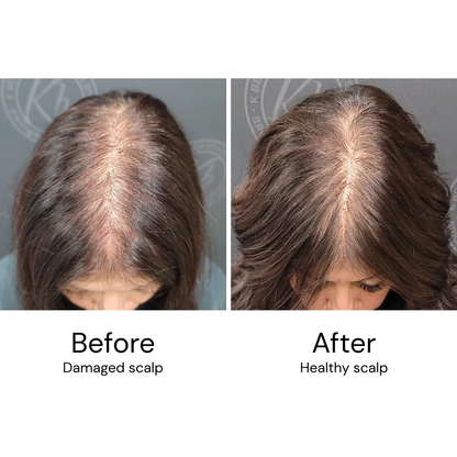 VitalHair Scalp Massager (+2 FREE Gifts)