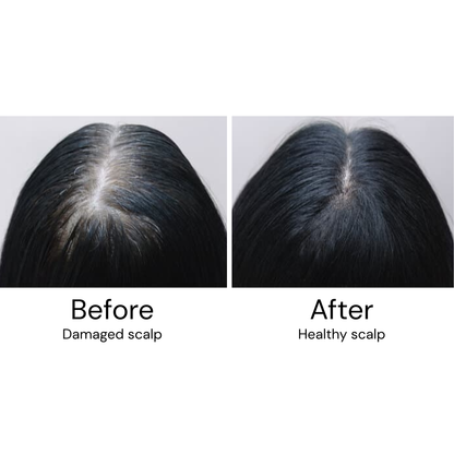 VitalHair Scalp Massager (+2 FREE Gifts)